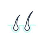 Hair Transplant